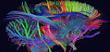 First 3D Map of the Brain’s Connections